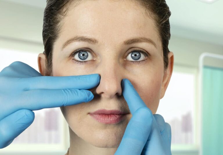 Deviated Septum Diagnosis